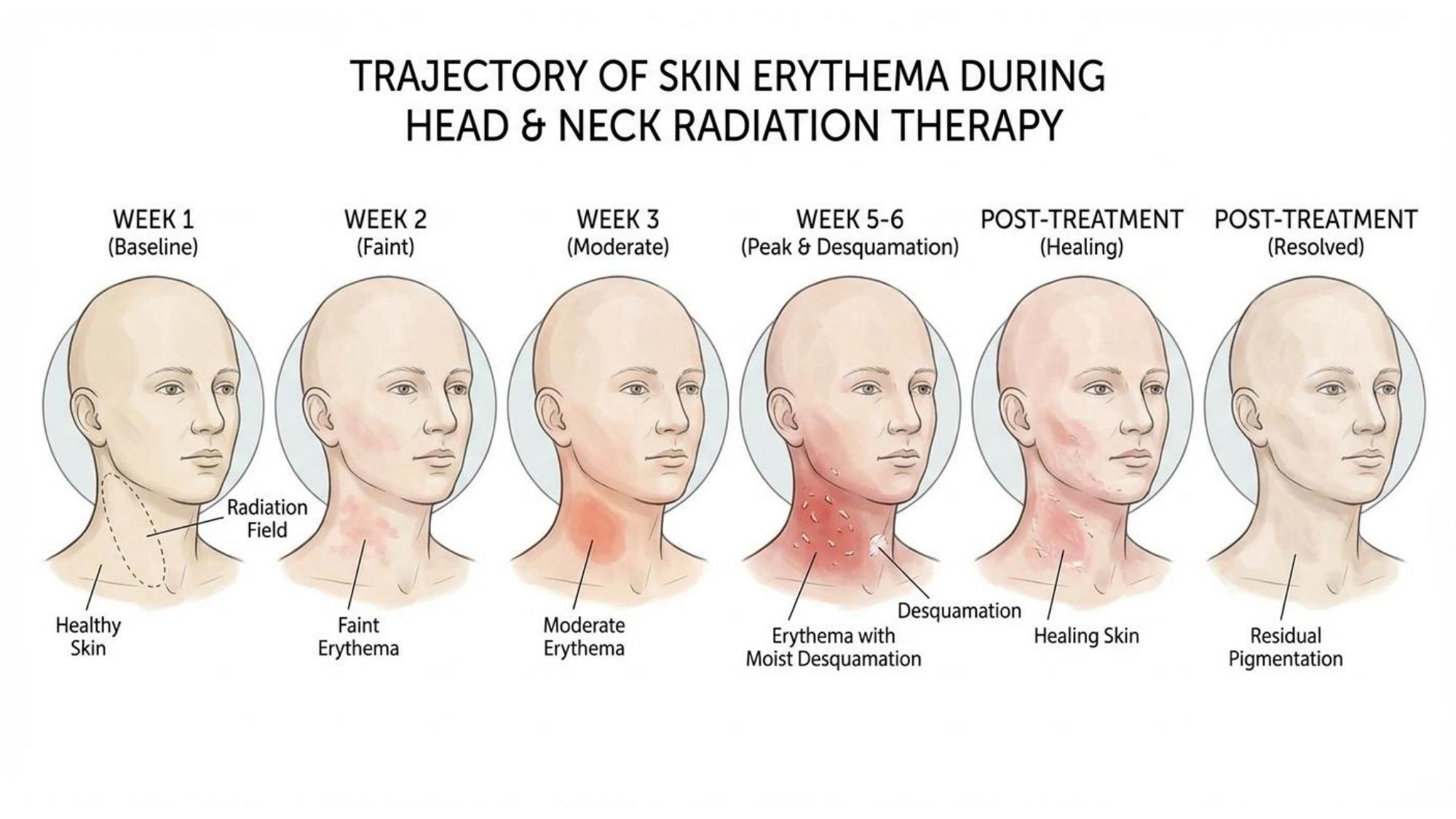 Timeline of skin changes during radiation therapy